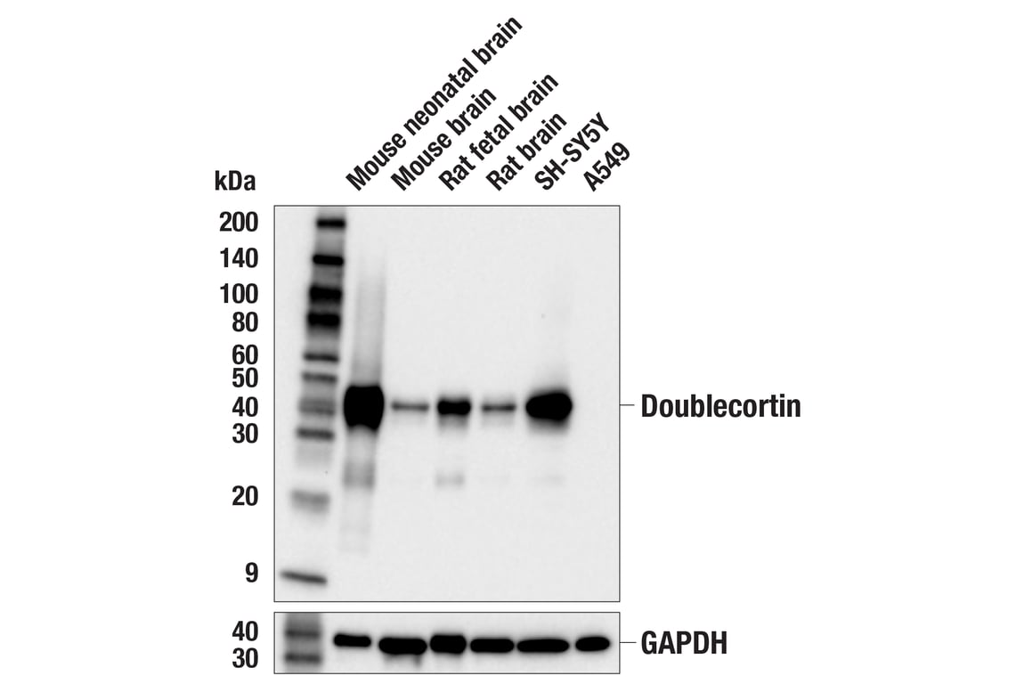 Western Blotting Image 1: Doublecortin (E3S7L) Rabbit mAb (BSA and Azide Free)