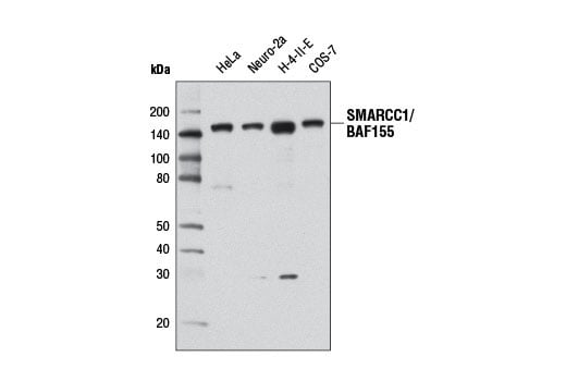 Western Blotting Image 1: SMARCC1/BAF155 (D7F8S) Rabbit mAb