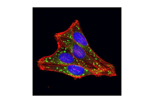 Immunofluorescence Image 1: Rab7 (D95F2) XP<sup>®</sup> Rabbit mAb