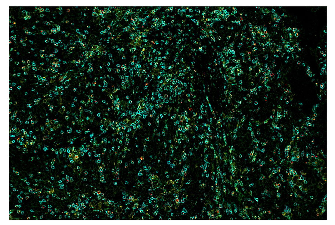 Immunohistochemistry Image 7: LAG3 (D2G4O<sup>™</sup>) & CO-0026-647 SignalStar<sup>™</sup> Oligo-Antibody Pair