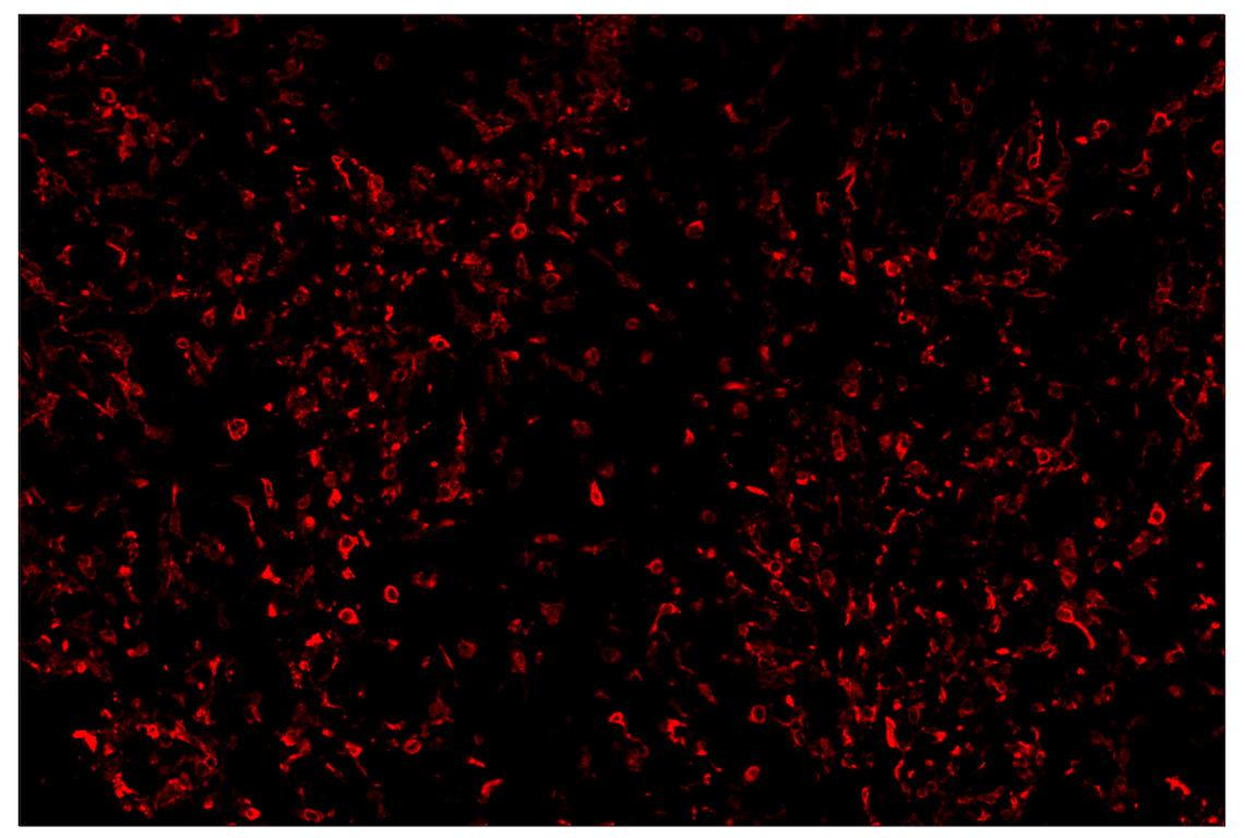 Immunohistochemistry Image 4: CD206/MRC1 (E6T5J) & CO-0032-594 SignalStar<sup>™</sup> Oligo-Antibody Pair