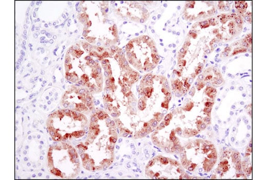 Immunohistochemistry Image 3: FGF Receptor 1 (D8E4) XP<sup>®</sup> Rabbit mAb (BSA and Azide Free)