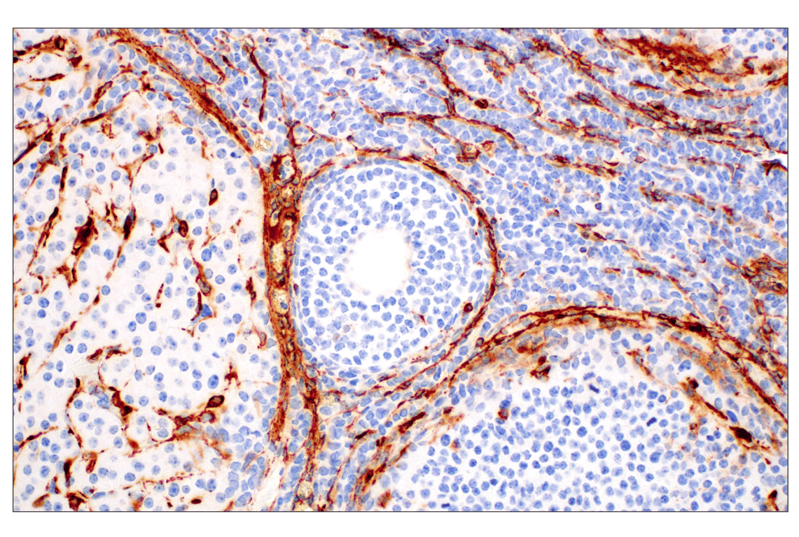 Immunohistochemistry Image 12: α-Smooth Muscle Actin (D4K9N) XP<sup>®</sup> Rabbit mAb (BSA and Azide Free)