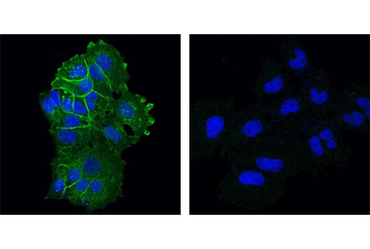 Immunofluorescence Image 1: DDR1 (D1G6) XP<sup>®</sup> Rabbit mAb (BSA and Azide Free)