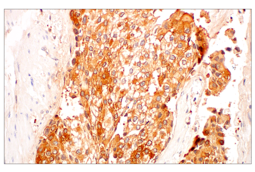 Immunohistochemistry Image 3: c-Rel (E8Z5Y) XP<sup>®</sup> Rabbit mAb (BSA and Azide Free)