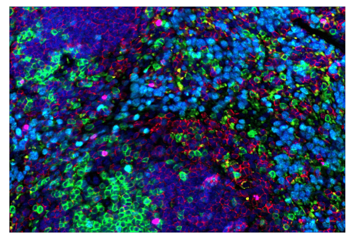 Immunohistochemistry Image 1: Neutrophil Elastase (E8U3X) & CO-0137-647 SignalStar<sup>™</sup> Oligo-Antibody Pair