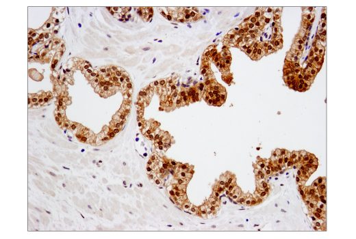 Immunohistochemistry Image 2: SMAD4 (D3R4N) XP<sup>®</sup> Rabbit mAb (BSA and Azide Free)