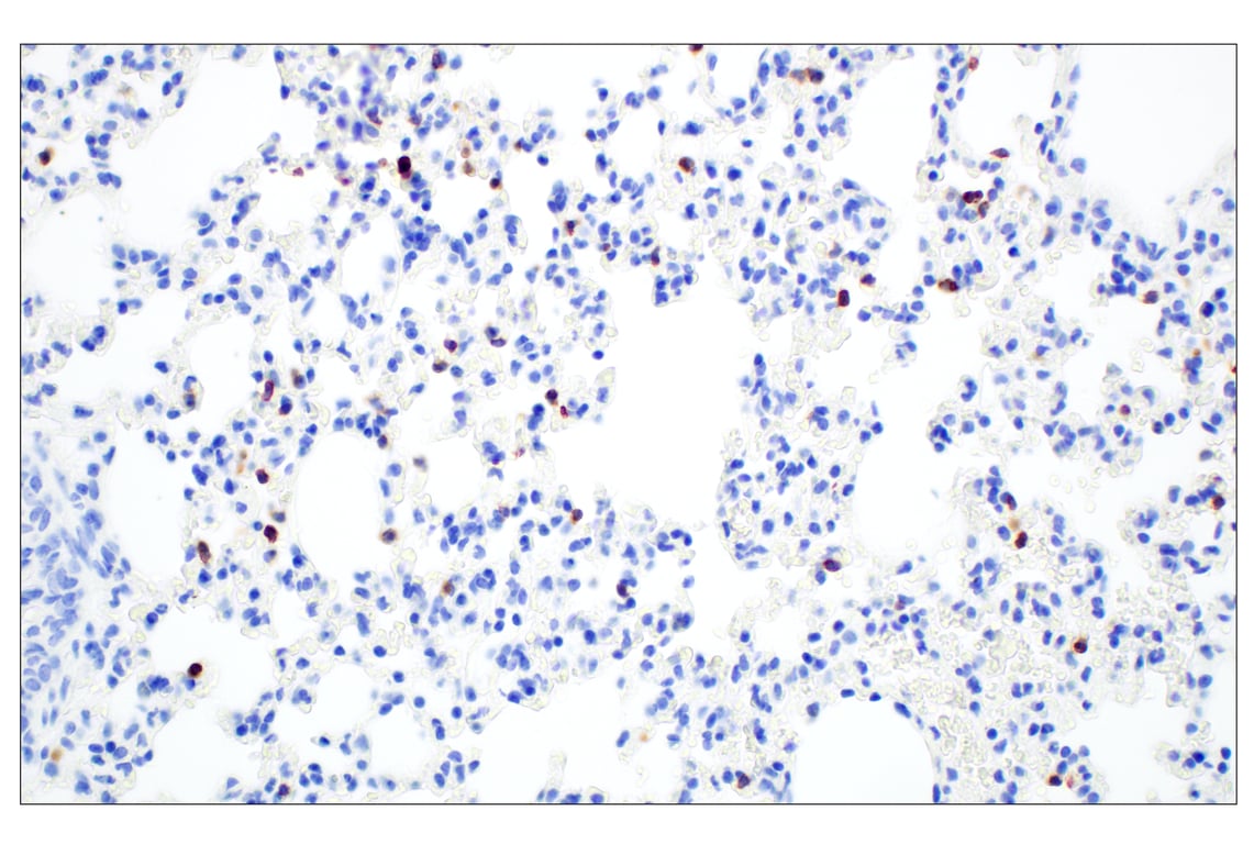 Immunohistochemistry Image 5: CD6 (E9Q1V) Rabbit mAb (BSA and Azide Free)