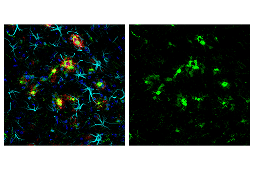Immunofluorescence Image 1: Iba1/AIF-1 (E4O4W) XP<sup>®</sup> Rabbit mAb (Alexa Fluor<sup>®</sup> 488 Conjugate)
