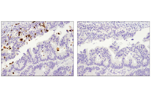 Immunohistochemistry Image 3: MMP-9 (D6O3H) XP<sup>®</sup> Rabbit mAb (BSA and Azide Free)