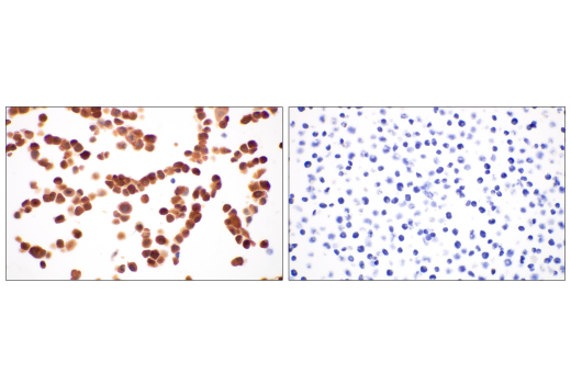 Immunohistochemistry Image 9: Asparagine Synthetase (E6C2C) XP<sup>®</sup> Rabbit mAb (BSA and Azide Free)