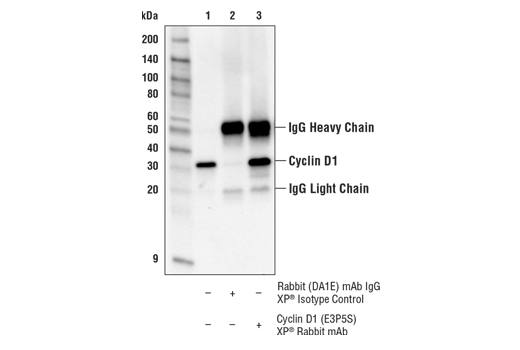 Immunoprecipitation Image 1: Cyclin D1 (E3P5S) XP<sup>®</sup> Rabbit mAb