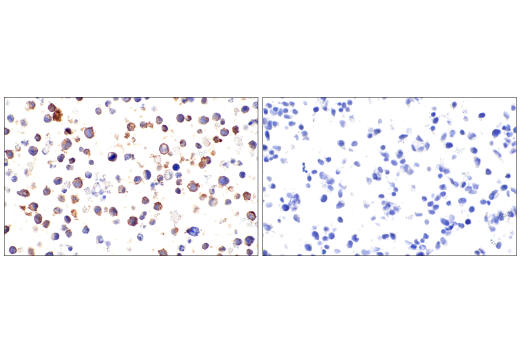 Immunohistochemistry Image 4: CD21/CR2 (2G9) Mouse mAb