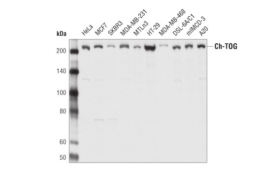 Western Blotting Image 2: Ch-TOG (D2Z8J) Rabbit mAb