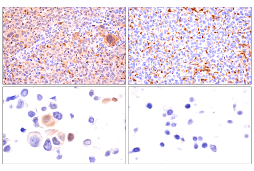 Immunohistochemistry Image 7: ASC/TMS1 (D2W8U) Rabbit mAb
