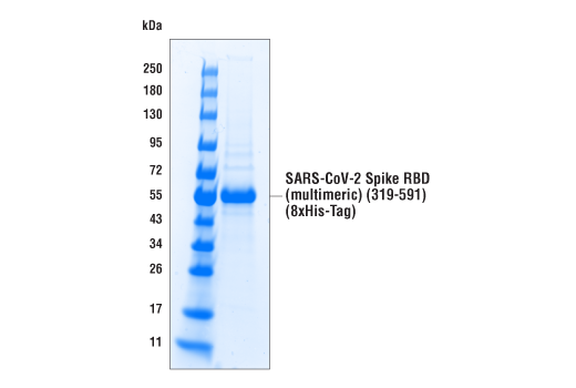 undefined Image 3: SARS-CoV-2 Spike RBD (multimeric) (319-591) Recombinant Protein (8xHis-Tag)