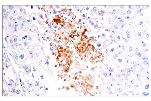 Immunohistochemistry Image 2: Fibrinogen gamma chain (E1U3Z) XP<sup>®</sup> Rabbit mAb