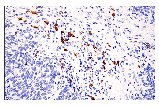 Immunohistochemistry Image 4: CD20 (E7B7T) XP<sup>®</sup> Rabbit mAb (BSA and Azide Free)