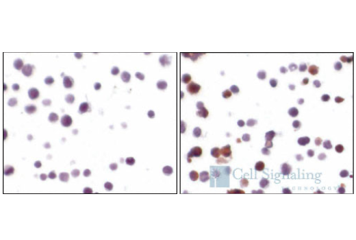 Immunohistochemistry Image 2: Cleaved Caspase-3 (Asp175) (5A1E) Rabbit mAb (BSA and Azide Free)