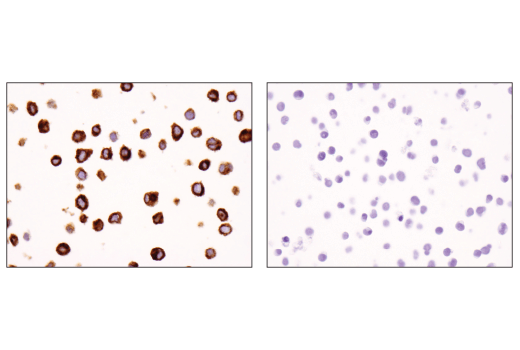 undefined Image 62: Human Exhausted CD8<sup>+</sup> T Cell IHC Antibody Sampler Kit