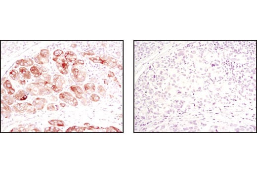 Immunohistochemistry Image 1: Acetyl-CoA Carboxylase (C83B10) Rabbit mAb (BSA and Azide Free)