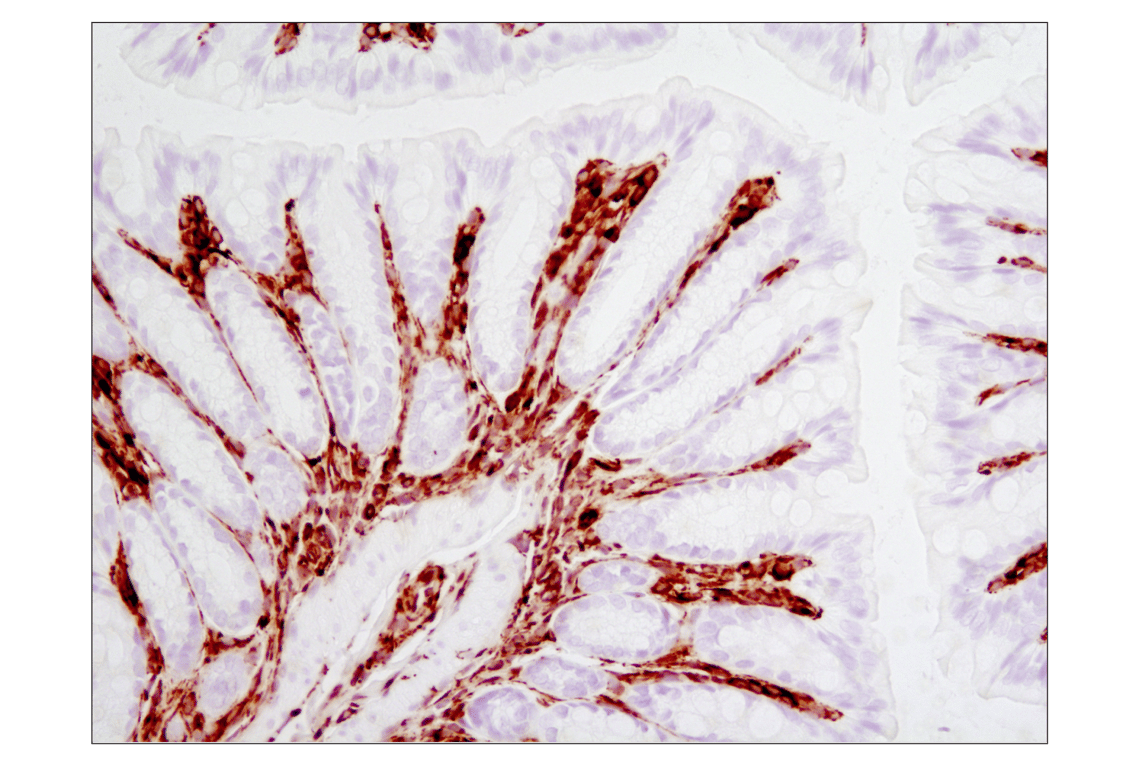 Immunohistochemistry Image 2: Vimentin (D21H3) XP<sup>®</sup> Rabbit mAb (BSA and Azide Free)