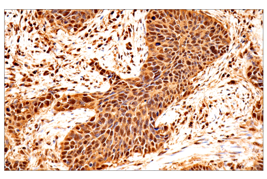 Immunohistochemistry Image 3: Ubiquitin (E6K4Y) XP<sup>®</sup> Rabbit mAb (BSA and Azide Free)