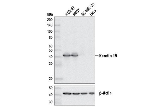 Western Blotting Image 1: Keratin 19 (D7F7W) Rabbit mAb