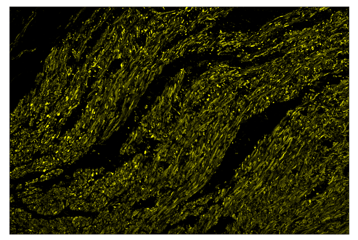 Immunohistochemistry Image 3: OX40L (D6K7R) & CO-0087-594 SignalStar<sup>™</sup> Oligo-Antibody Pair