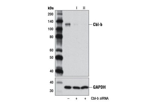 undefined Image 1: SignalSilence<sup>®</sup> Cbl-b siRNA I