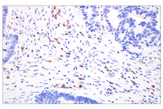 Immunohistochemistry Image 2: CD70 (E3Q1A) Rabbit mAb (BSA and Azide Free)