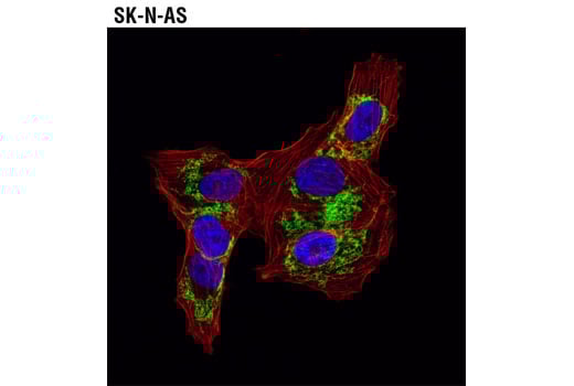 Immunofluorescence Image 1: DyLight 554 Phalloidin