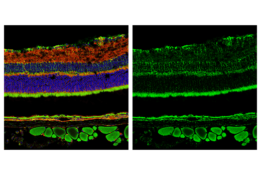 Immunofluorescence Image 4: MAVS (E8Z7M) Rabbit mAb