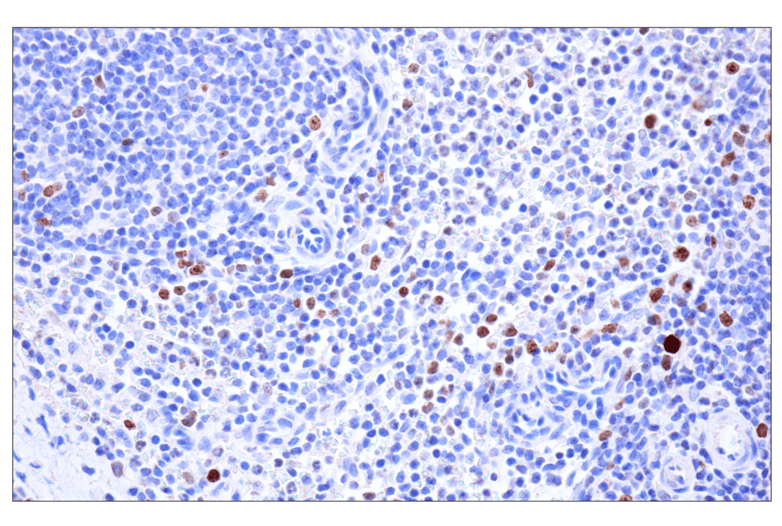 Immunohistochemistry Image 4: Ki-67 (8D5) Mouse mAb