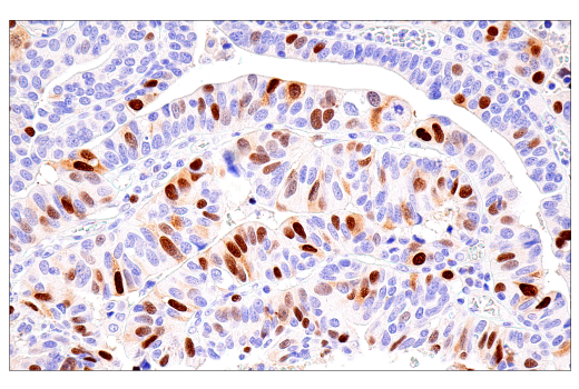 Immunohistochemistry Image 1: Cyclin A2 (E6D1J) XP<sup>®</sup> Rabbit mAb