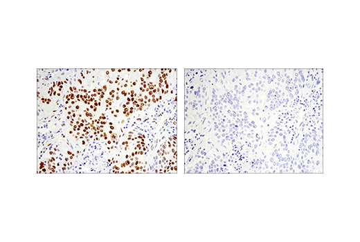 Immunohistochemistry Image 4: Phospho-ATF-2 (Thr71)/ATF-7 (Thr53) (E4A5G) XP<sup>®</sup> Rabbit mAb