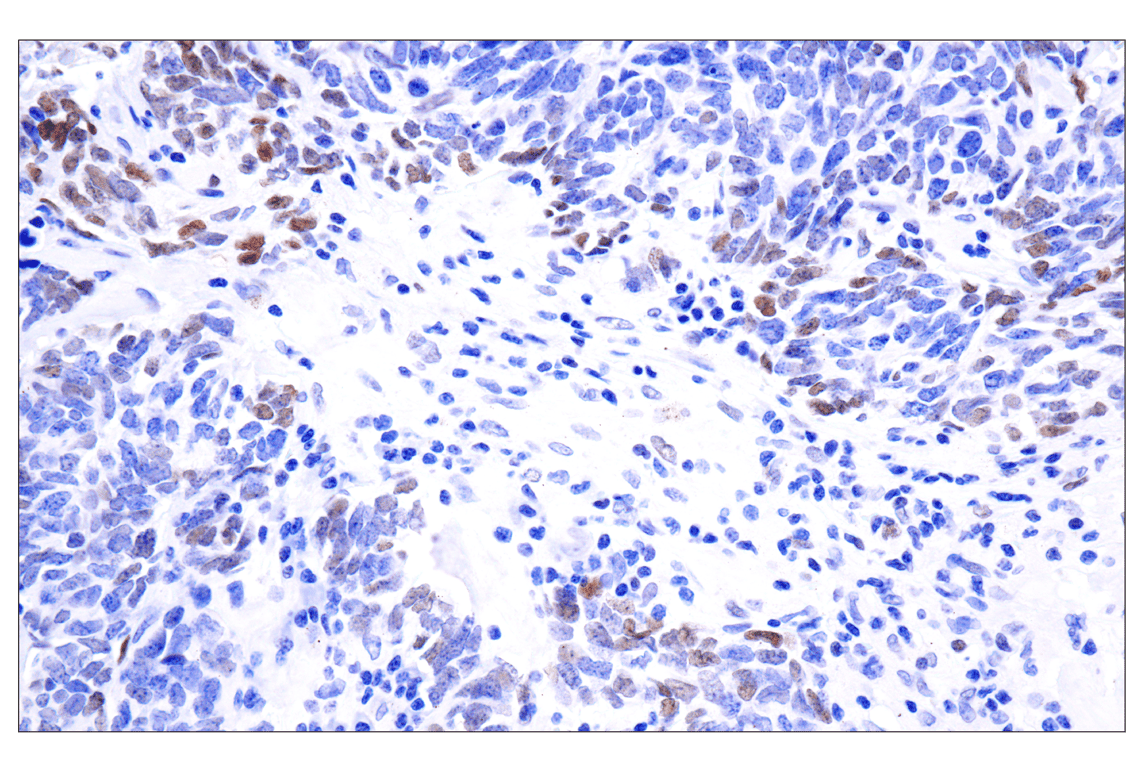 undefined Image 20: Stat3/Stat5 Signaling Antibody Sampler Kit