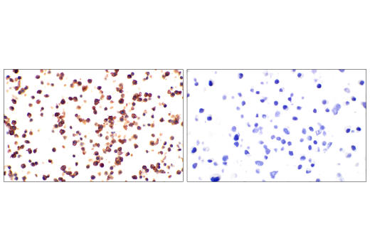Immunohistochemistry Image 1: Integrin β2 (E9O7W) Rabbit mAb (BSA and Azide Free)