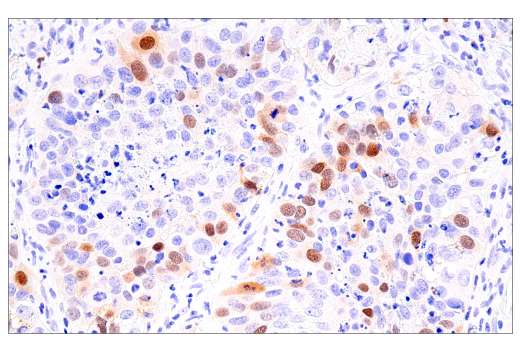 Immunohistochemistry Image 3: Cyclin A2 (E6D1J) XP<sup>®</sup> Rabbit mAb