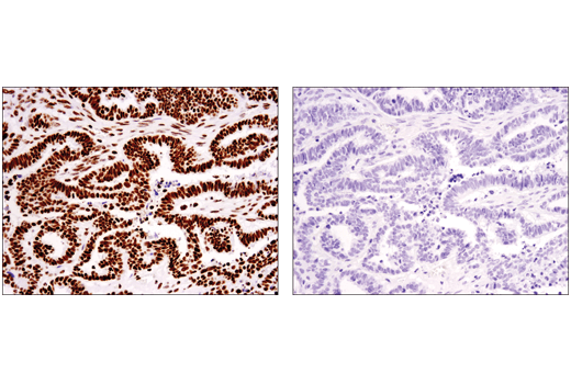 Immunohistochemistry Image 4: Tri-Methyl-Histone H3 (Lys36) (D5A7) XP<sup>®</sup> Rabbit mAb