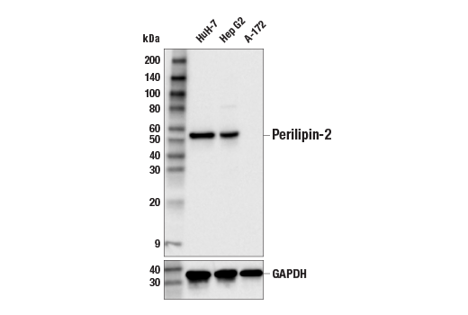 Western Blotting Image 1: Perilipin-2 (E6G6M) Rabbit mAb
