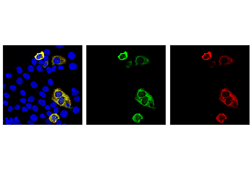Immunofluorescence Image 1: Cas9 (<i>S. aureus</i>) (6H4) Mouse mAb