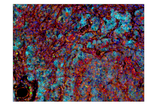 Immunohistochemistry Image 2: B7-H4 (D1M8I) XP<sup>®</sup> Rabbit mAb (BSA and Azide Free)