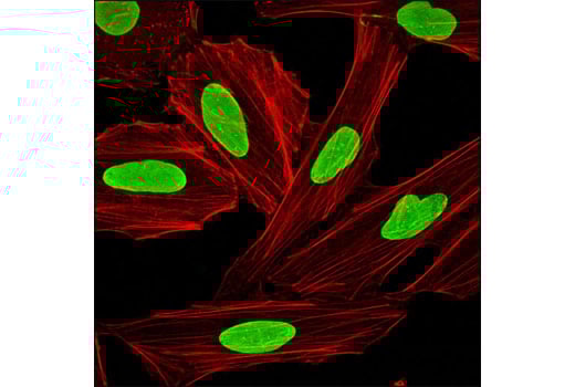 undefined Image 53: Microglia Cross Module Antibody Sampler Kit