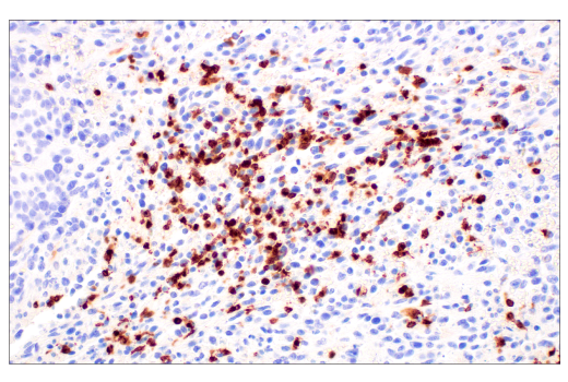 Immunohistochemistry Image 1: CD177 (E1V7N) Rabbit mAb (BSA and Azide Free)