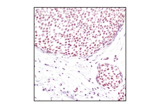 Immunohistochemistry Image 1: Di-Methyl-Histone H3 (Lys4) (C64G9) Rabbit mAb