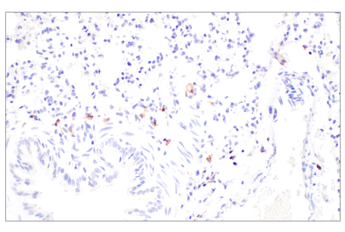 BDNF Recombinant Rabbit Monoclonal Antibody [SJ12-09