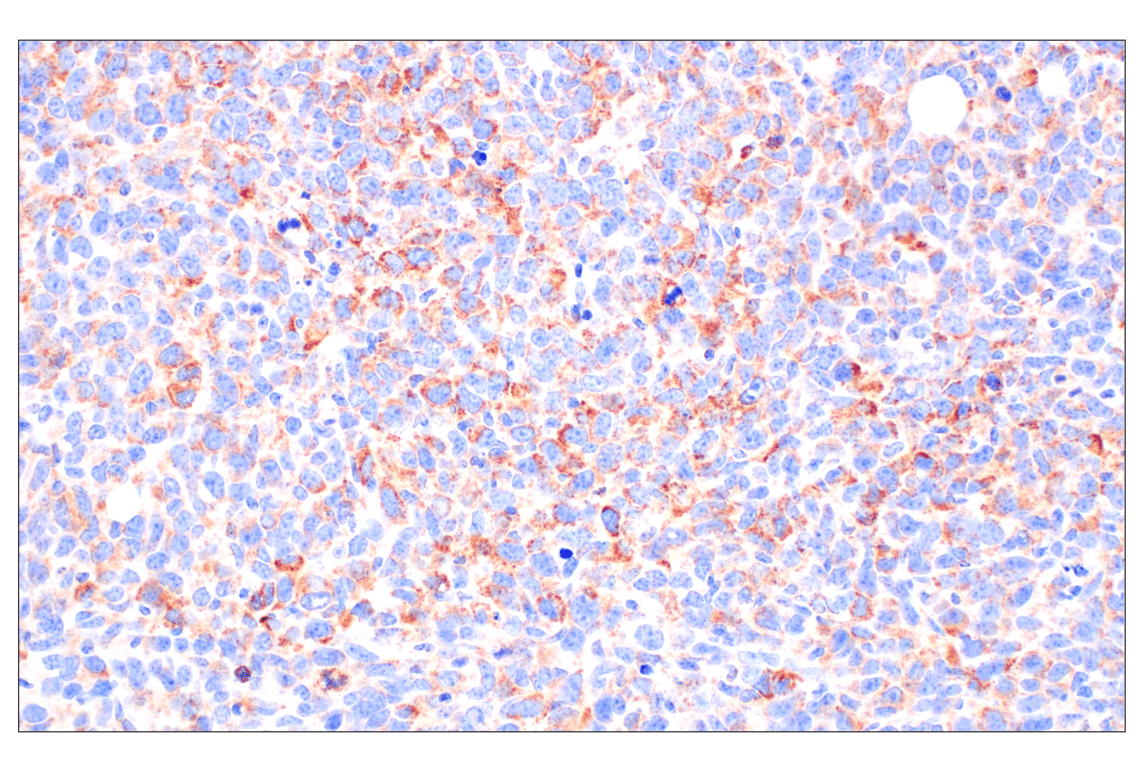 undefined Image 52: Cell Fractionation Antibody Sampler Kit