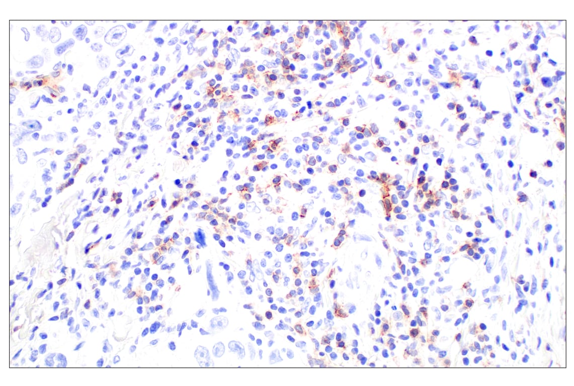 Immunohistochemistry Image 5: CD62L/L-Selectin (E7X9I) Rabbit mAb (BSA and Azide Free)