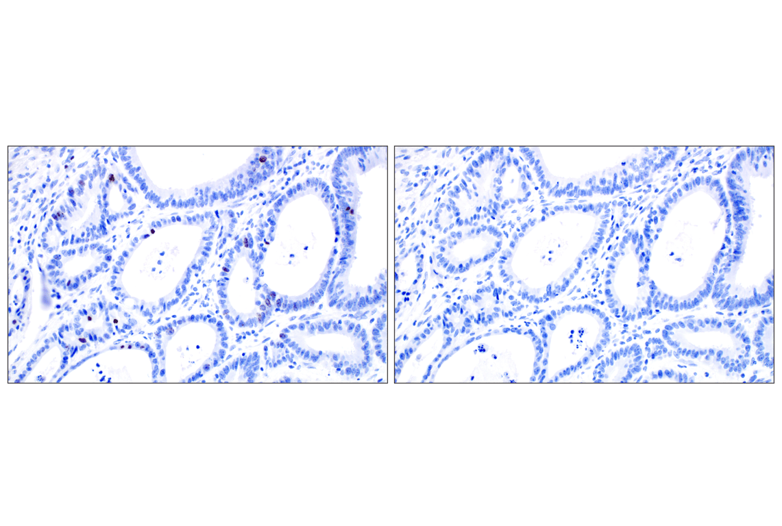 Immunohistochemistry Image 8: Phospho-Histone H3 (Ser10) (D7N8E) XP<sup>®</sup> Rabbit mAb (BSA and Azide Free)